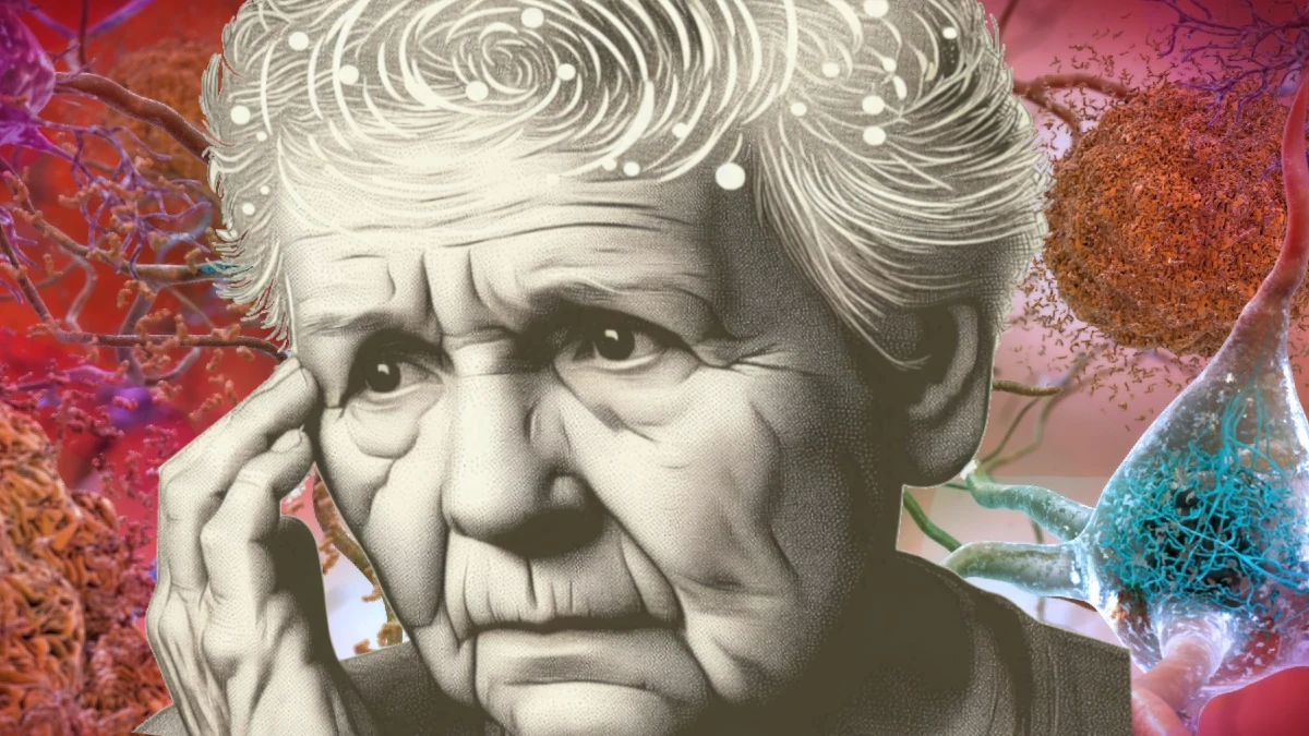 New Research Links Herpes Virus to Alzheimer’s Disease, Opening Doors for Prevention