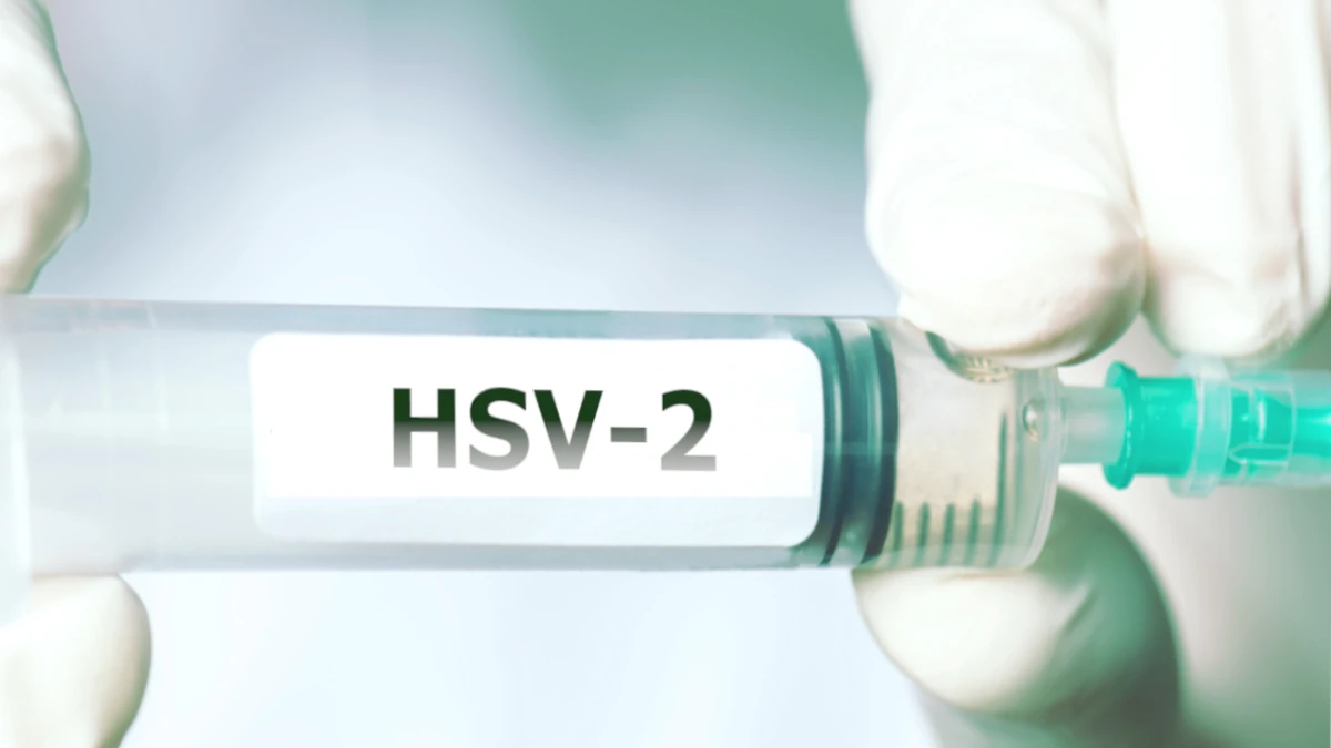 Genital Herpes: A $35.3 Billion Economic Burden on the Global Economy