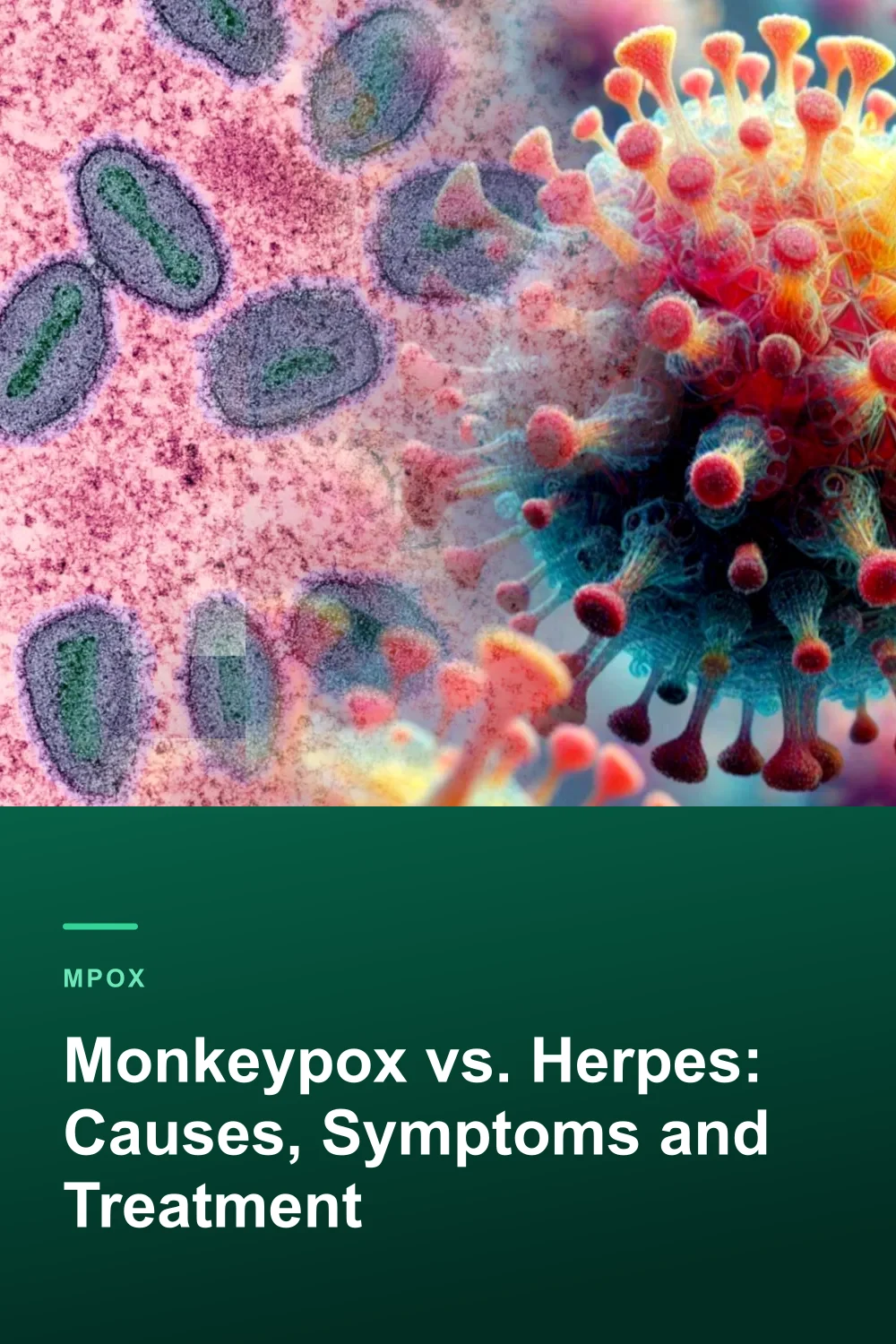 Monkeypox vs. Herpes: Causes, Symptoms and Treatment